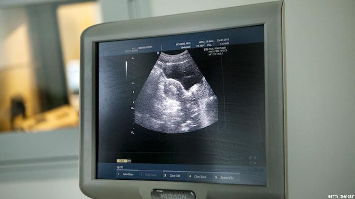 A 61-Year-Old Woman Gave Birth to Her Gay Son's Daughter