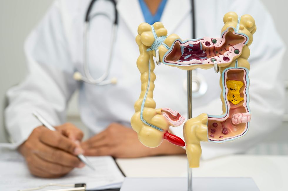 A model of the digestive tract in front of a doctor