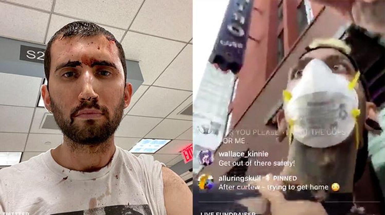 Activists brutalized in Black Lives Matter protests.