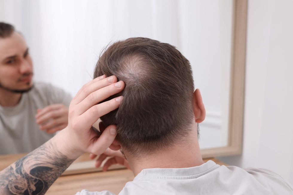 Balding man looking in the mirror.