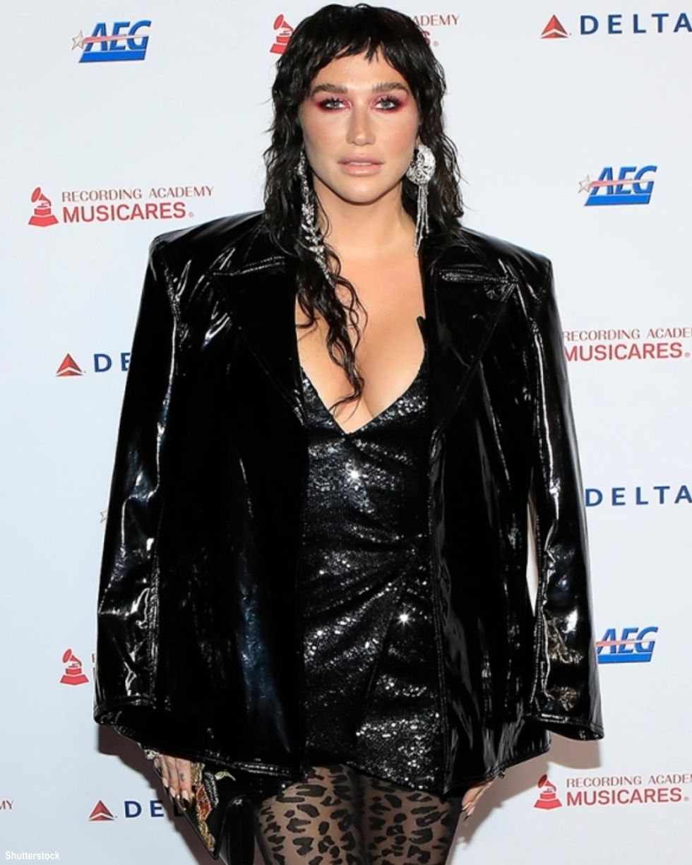 Ed Sheeran Beats Out Kesha & Lady Gaga at the Grammys Awards