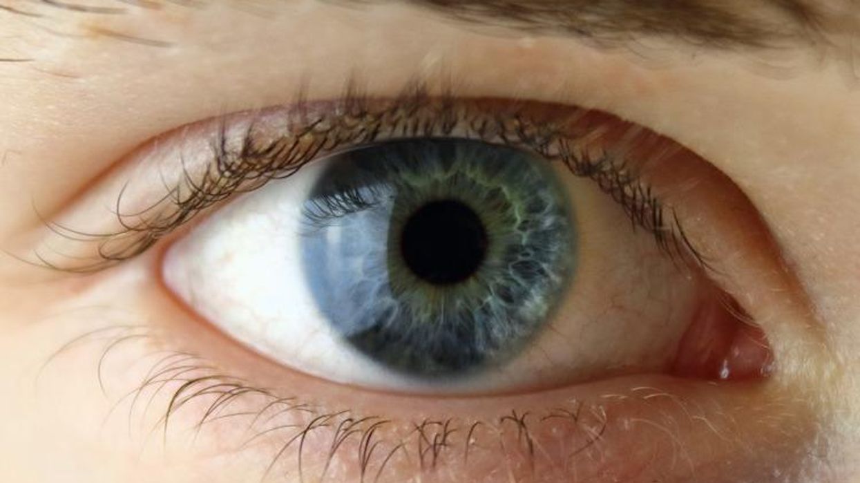 Eye
