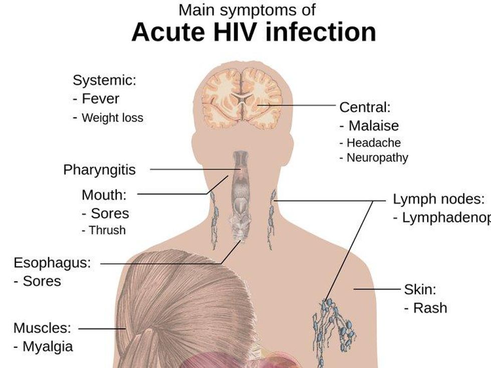 HIV is a non-issue these days.