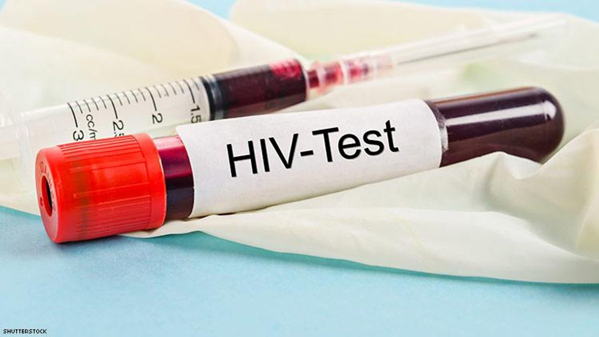 HIV TEST