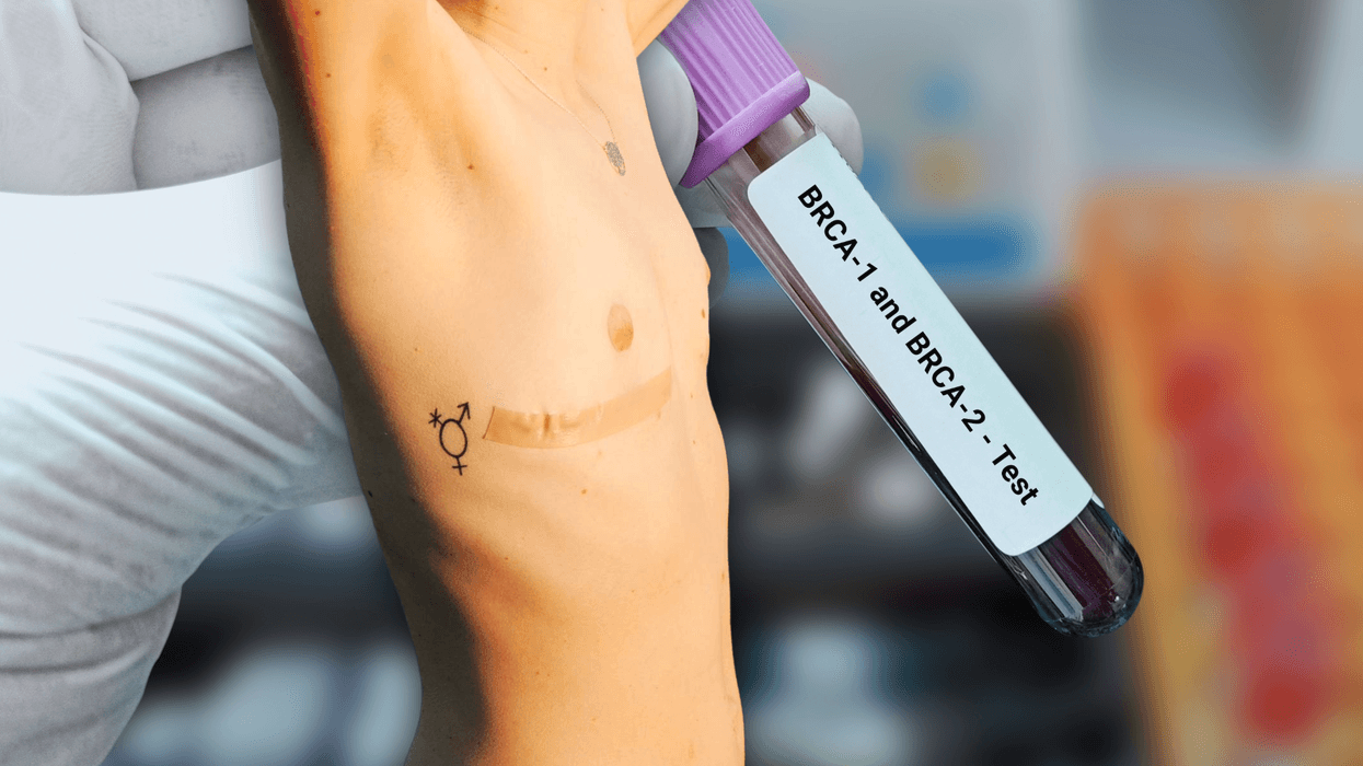 Trans top surgery patients aren't getting enough info about breast cancer screening, study says