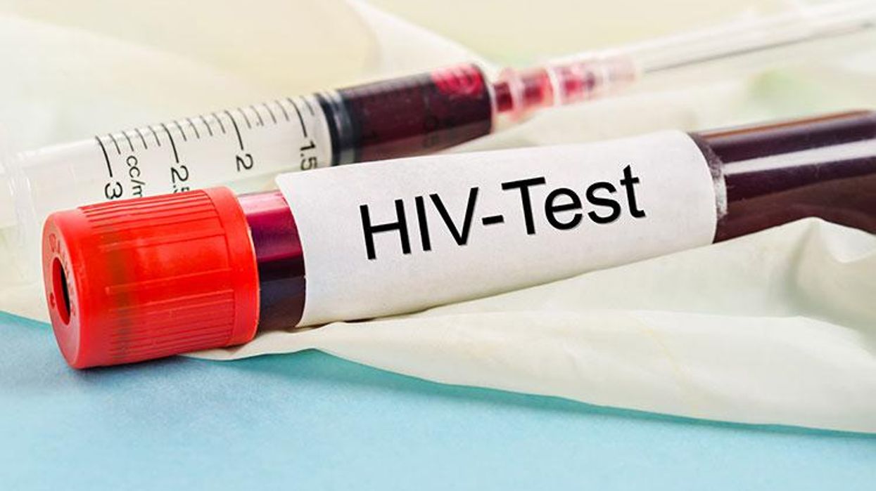 Is-it-possible-i-got-a-false-positive-on-my-hiv-testx750