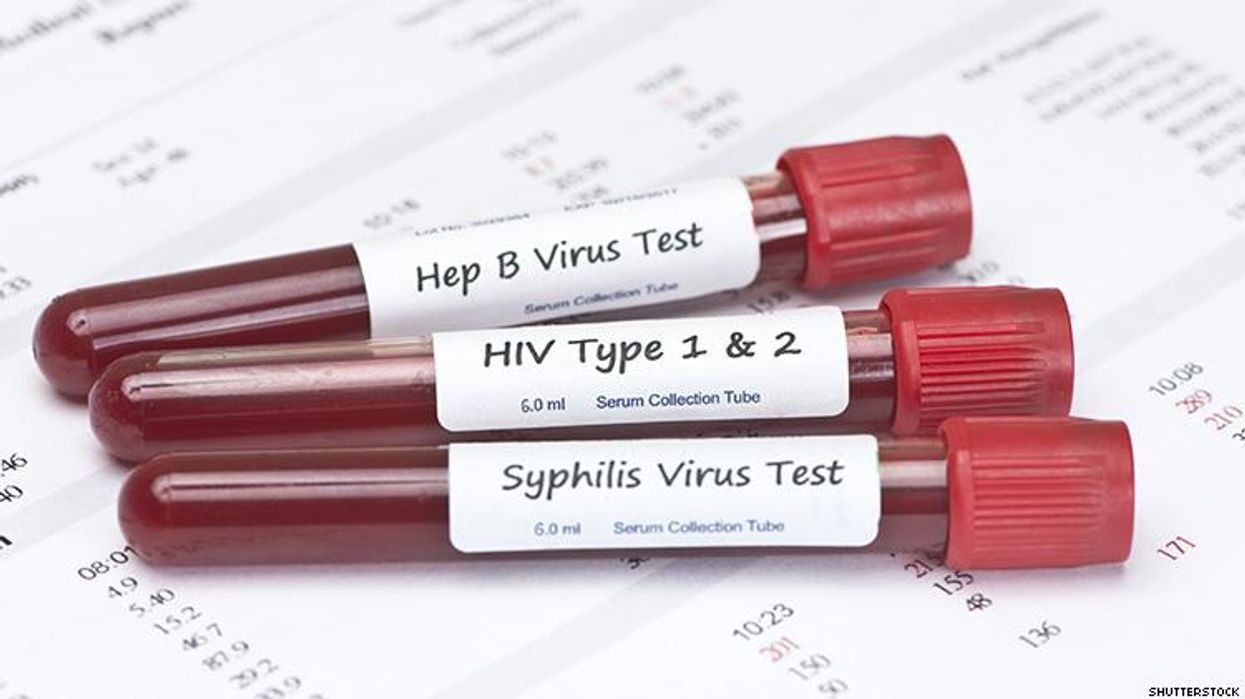 LA County Cuts Funding for STI Testing and Treatment in LGBT Center