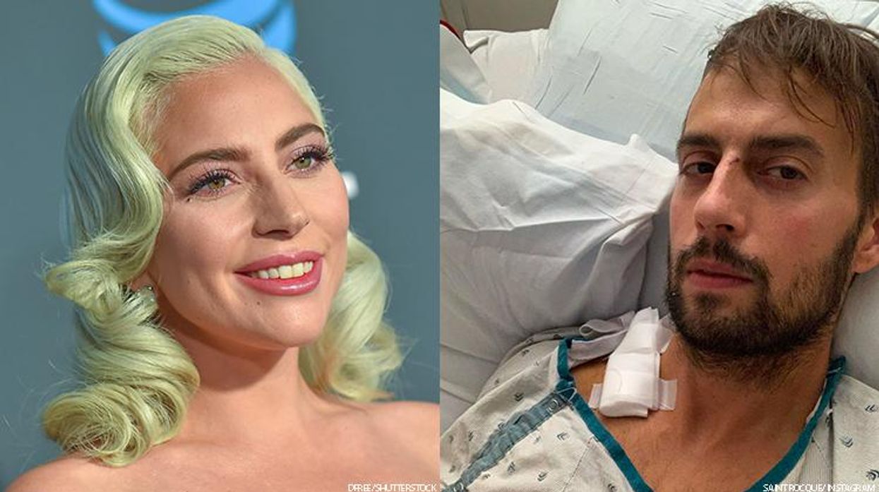 Lady Gaga’s Dogwalker Describes Getting Shot Protecting Dogs