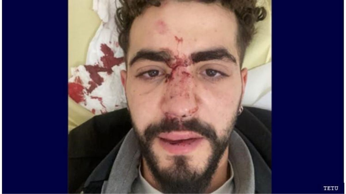 Man beaten by homophobic uber driver