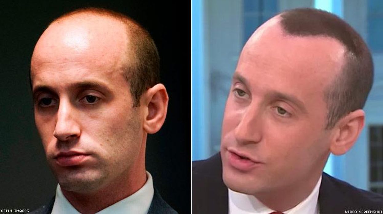 Miller Hairline