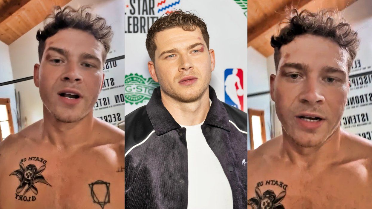 Oliver Stark via Instagram Story; Oliver Stark at Ruffles NBA All-Star Celebrity Game at Oakland Arena in February 2025