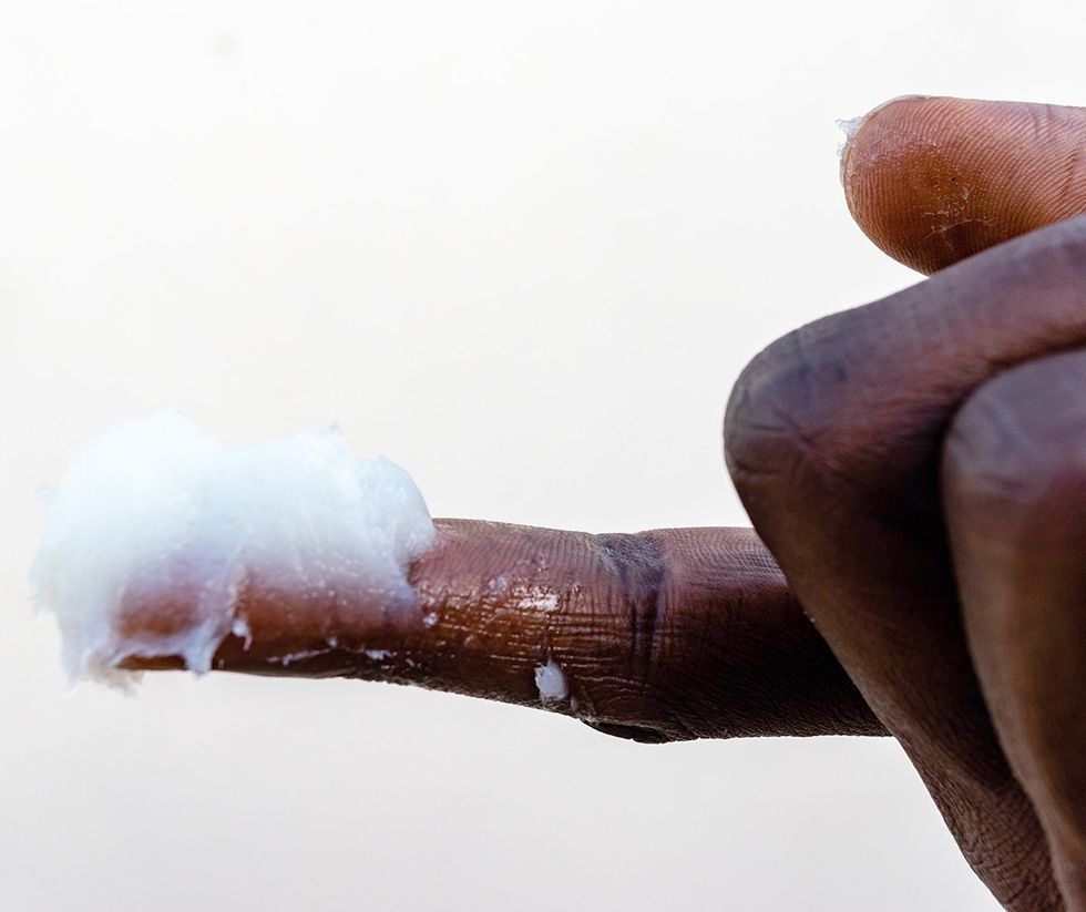 Petroleum jelly on index finger