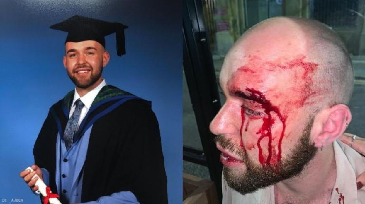 Police in England Arrest Two for Brutal Attack on Gay Man in Liverpool