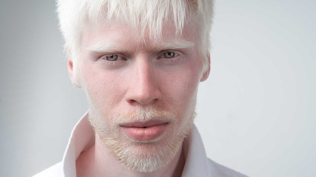 Sad man white skin hair studio dressed t-shirt isolated white background