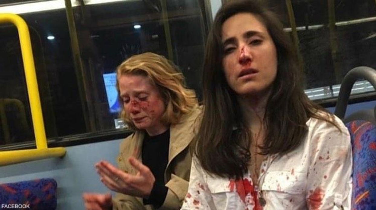 Teenage Boys Plead Guilty to Brutal Bus Attack on Lesbian Couple