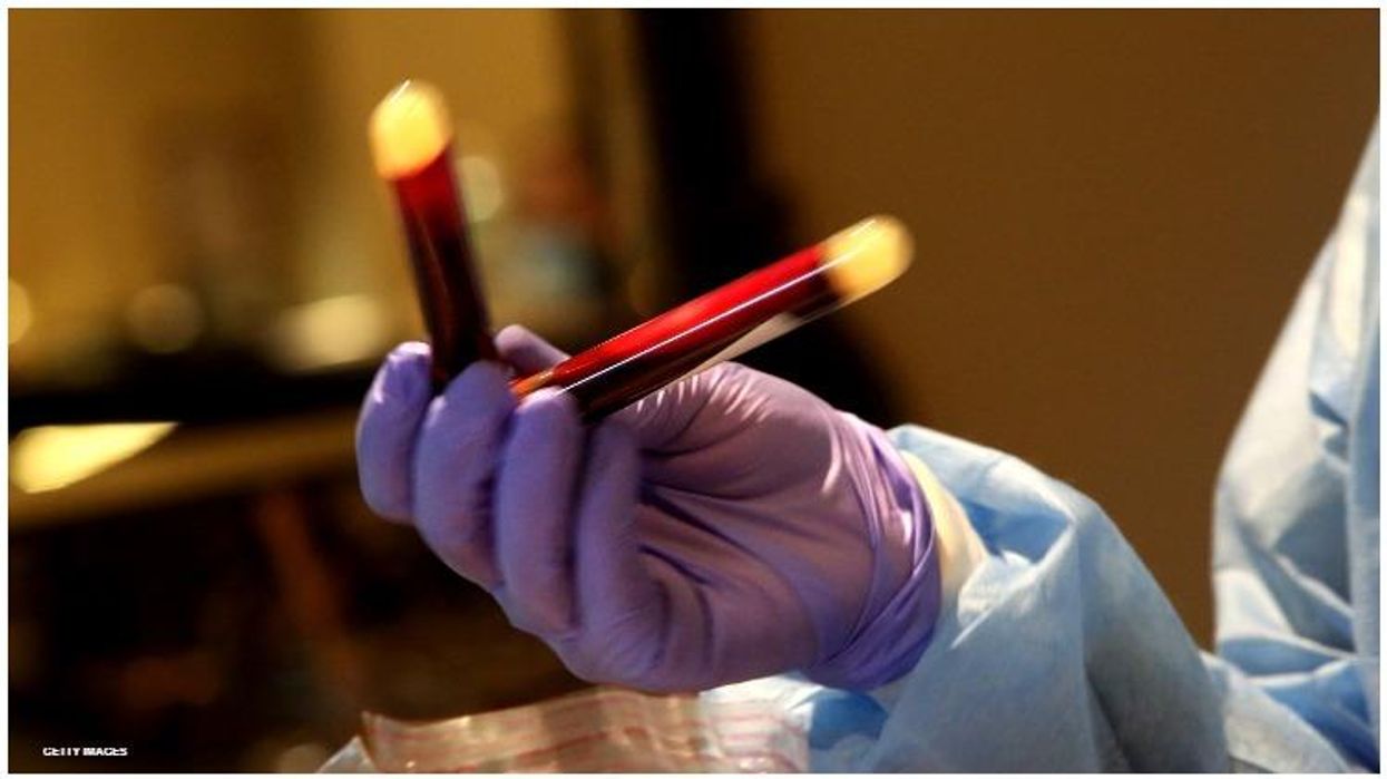 UK partially rolled back restrictions on blood donations from gay and bisexual men.