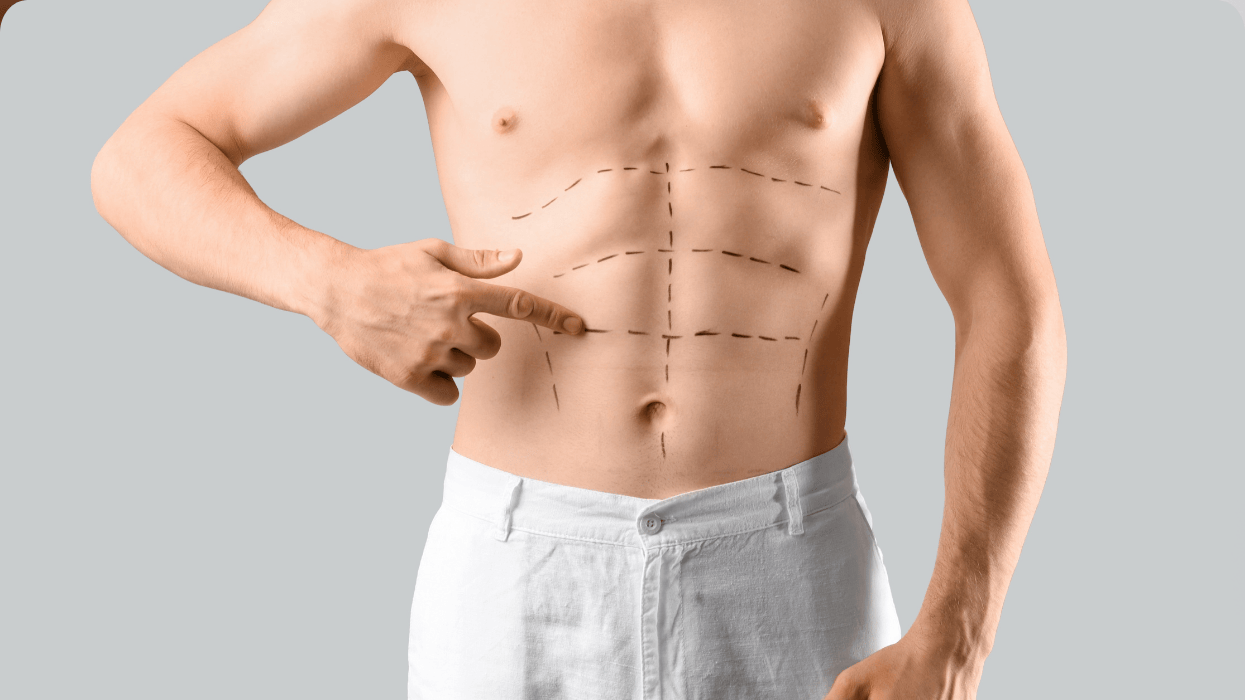 Young man pointing at markings on his abdomen against grey background. Plastic surgery concept