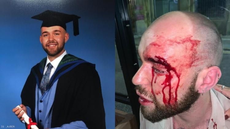 Police in England Arrest Two for Brutal Attack on Gay Man in Liverpool