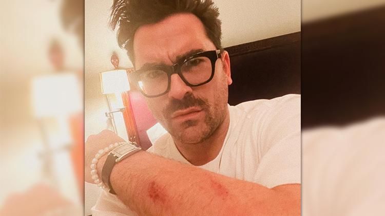 dan-levy-fall-trip-injury-instagram-post.jpg